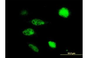 Immunofluorescence of purified MaxPab antibody to TUSC4 on HeLa cell. (NPRL2 anticorps  (AA 1-380))