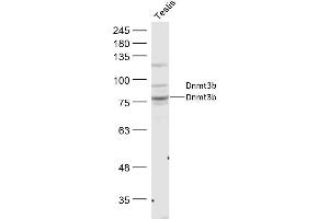 Mouse Testis lysates probed with Dnmt3b Polyclonal Antibody, Unconjugated  at 1:300 dilution and 4˚C overnight incubation. (DNMT3B anticorps  (AA 251-350))
