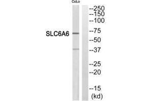 Western blot analysis of extracts from COLO205 cells, using SC6A6 antibody. (TAUT anticorps)
