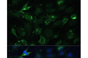 Immunofluorescence analysis of C6 cells using COX6A1 Polyclonal Antibody at dilution of 1:100 (40x lens).