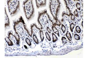 IHC analysis of Musashi 1/Msi1 using anti- Musashi 1/Msi1 antibody .