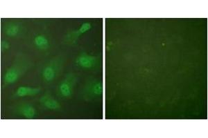 Immunofluorescence analysis of HeLa cells, using CSE1L Antibody. (Exportin 2 anticorps  (AA 1-50))