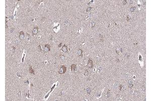 ABIN6268744 at 1/100 staining human brain tissue sections by IHC-P. (BMP6 anticorps  (Internal Region))