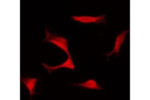 ABIN6267684 staining COS7 by IF/ICC. (Aurora Kinase B anticorps  (pThr232))