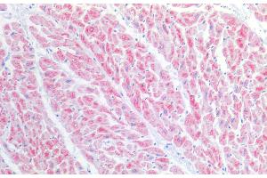 Immunohistochemistry of paraffin-embedded Human heart tissue using BST1 Polyclonal Antibody at dilution of 1:100. (BST1 anticorps)