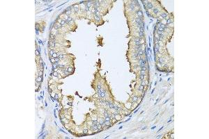 Immunohistochemistry of paraffin-embedded human prostate using ATG5 antibody. (ATG5 anticorps  (AA 1-275))