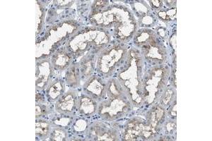 Immunohistochemical staining of human kidney with SLC38A6 polyclonal antibody  shows moderate positivity in cytoplasm and membranes.