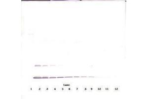 Image no. 3 for anti-Interleukin 2 (IL2) antibody (Biotin) (ABIN465290) (IL-2 anticorps  (Biotin))
