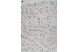 Immunohistochemistry (Formalin/PFA-fixed paraffin-embedded sections) of mouse kidney (A) and mouse epididymis (B) with Usp11 polyclonal antibody . (USP11 anticorps)