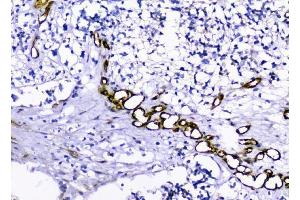 IHC analysis of Caveolin-1/CAV1 using anti-Caveolin-1/CAV1 antibody (ABIN3043803). (Caveolin-1 anticorps  (AA 4-178))