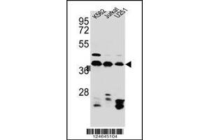 Western blot analysis in Jurkat,K562,U251 cell line lysates (35ug/lane). (HNRNPC anticorps  (C-Term))