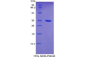 SDS-PAGE analysis of Mouse TNNT1 Protein. (TNNT1 Protéine)