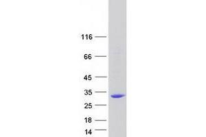 Validation with Western Blot