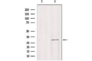 Western blot analysis of extracts from mouse lung, using Galc antibody.