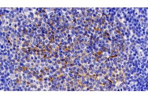 anti-Interleukin 11 Receptor, alpha (IL11RA) (AA 59-220) antibody