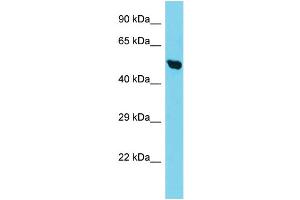 Host: Rabbit Target Name: TIMM50 Sample Type: HepG2 Whole Cell lysates Antibody Dilution: 1. (TIMM50 anticorps  (C-Term))