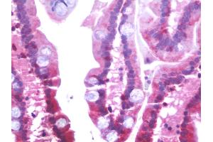 Anti-SLC6A19 antibody IHC staining of human small intestine. (SLC6A19 anticorps)
