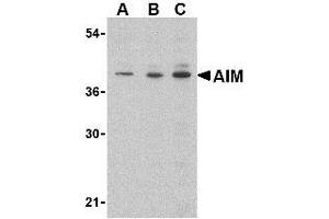 Western blot analysis of AIM in Raji lysate with AP30034PU-N AIM antibody at (A) 0. (CD5L anticorps  (C-Term))