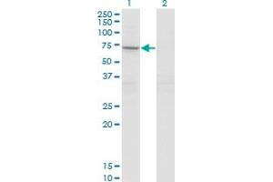 Western Blot analysis of STAM2 expression in transfected 293T cell line by STAM2 monoclonal antibody (M01), clone 1A10.