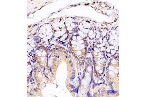 Immunohistochemistry of paraffin embedded rat colon using SRP14 (ABIN7075596) at dilution of 1:300 (400x lens)