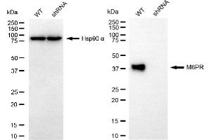 anti-Mannose-6-Phosphate Receptor (Cation Dependent) (M6PR) antibody