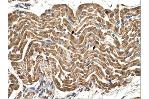ATP5B antibody was used for immunohistochemistry at a concentration of 4-8 ug/ml.