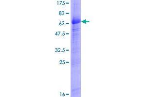 Image no. 1 for Integral Membrane Protein 2B (ITM2B) (AA 1-266) protein (GST tag) (ABIN1308239)