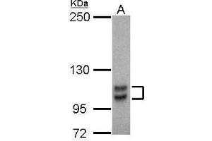WB Image Sample (30 ug of whole cell lysate) A: THP-1 5% SDS PAGE antibody diluted at 1:1000