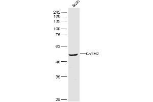 Mouse brain lysates probed with ChRM2 Polyclonal Antibody, Unconjugated  at 1:500 dilution and 4˚C overnight incubation.