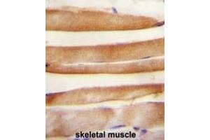 ARV1 antibody (N-term) immunohistochemistry analysis in formalin fixed and paraffin embedded human skeletal muscle followed by peroxidase conjugation of the secondary antibody and DAB staining.
