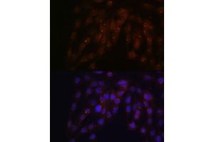 Immunofluorescence analysis of C6 cells using CUX1 antibody (ABIN1679438, ABIN3015866, ABIN3015867 and ABIN6219446) at dilution of 1:100.