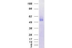 Validation with Western Blot