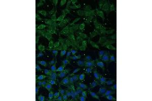 Immunofluorescence analysis of L929 cells using NF-kB p65/RelA antibody (ABIN3016234, ABIN3016235, ABIN3016236 and ABIN6219643) at dilution of 1:100.