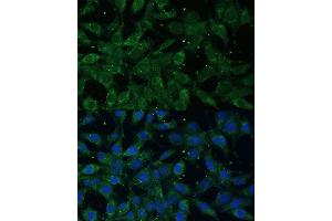 Immunofluorescence analysis of L929 cells using NF-kB p65/RelA antibody (ABIN3016234, ABIN3016235, ABIN3016236 and ABIN6219643) at dilution of 1:100. (NF-kB p65 anticorps  (AA 50-180))