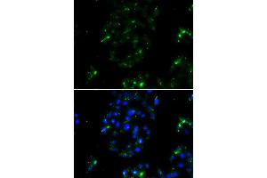 Immunofluorescence analysis of A549 cell using BOC antibody. (BOC anticorps)