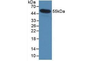 Detection of Recombinant IL35, Human using Monoclonal Antibody to Interleukin 35 (IL35) (Interleukin 35 anticorps  (AA 23-219))