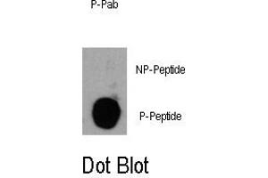 Image no. 1 for anti-Phosphoinositide-3-Kinase, Catalytic, delta Polypeptide (PIK3CD) (pTyr485) antibody (ABIN358424) (PIK3CD anticorps  (pTyr485))