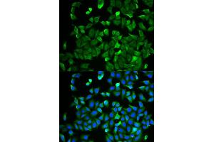 Immunofluorescence analysis of HeLa cell using NF2 antibody. (Merlin anticorps)