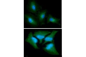 ICC/IF analysis of GOT1 in A549 cells line, stained with DAPI (Blue) for nucleus staining and monoclonal anti-human GOT1 antibody (1:100) with goat anti-mouse IgG-Alexa fluor 488 conjugate (Green).
