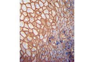 Paraformaldehyde-fixed, paraffin embedded SAMPLE tissue, Antigen retrieval by boiling in sodium citrate buffer (pH6.