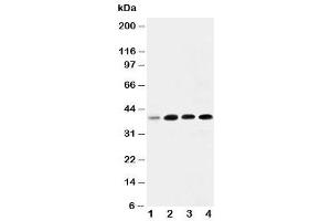 Western blot testing of IGFBP3 antibody and Lane 1:  293T