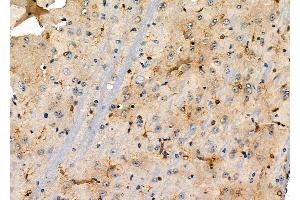 ABIN6263390 and ABIN6274052 at 1/100 staining Mouse brain tissue by IHC-P.