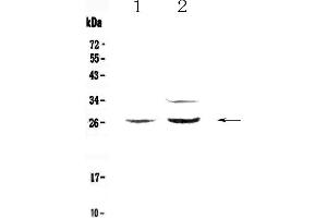 Western blot analysis of Betacellulin using anti-Betacellulin antibody . (Betacellulin anticorps  (AA 32-177))