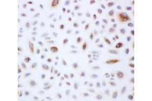 Peroxiredoxin 3 antibody and A549 cells tested by ICC
