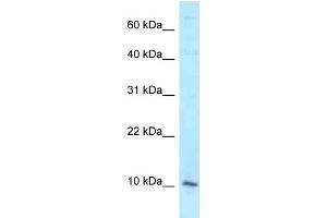 WB Suggested Anti-DAP Antibody Titration: 1. (DAP anticorps  (Middle Region))