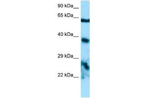 WB Suggested Anti-EPYC Antibody Titration: 1.