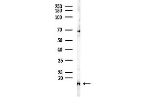anti-Translocase of Inner Mitochondrial Membrane 13 Homolog (TIMM13) (C-Term) antibody