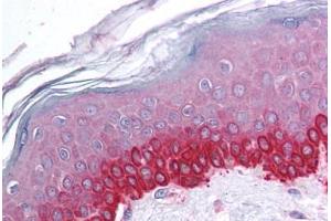 Human Skin (formalin-fixed, paraffin-embedded) stained with CTCF antibody ABIN214093 at 5 ug/ml followed by biotinylated goat anti-rabbit IgG secondary antibody ABIN481713, alkaline phosphatase-streptavidin and chromogen.