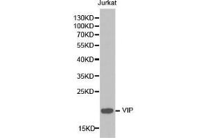 Western blot analysis of extracts of Jurkat cell lines, using VIP antibody. (Vip anticorps  (AA 31-170))