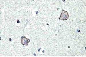 Image no. 2 for anti-Lysophosphatidic Acid Receptor 1 (LPAR1) antibody (ABIN317688)